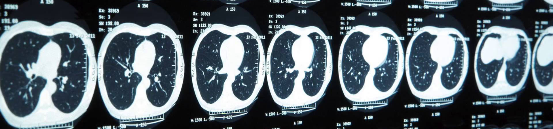 Erstellung einer App für die Lokalisation des Hirntumors